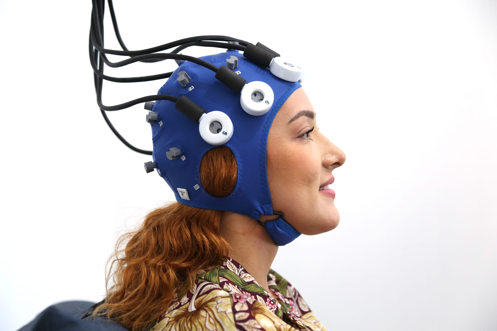 Estimulación Magnetica Transcraneal para la depresión, insomnio, Tdah, Ansiedad, trastorno alimenticio